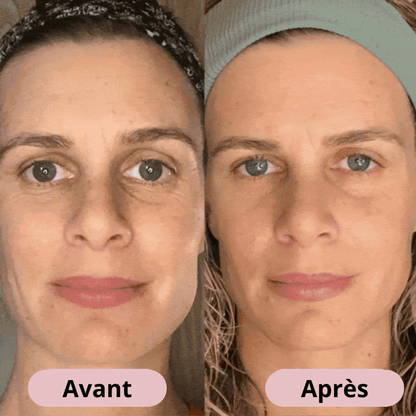 VitaLift Pro | Appareil Liftant Visage + Sérum Anua Offert