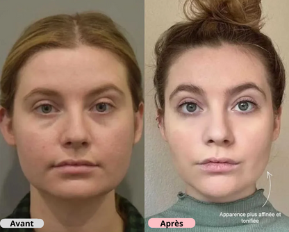 VitaLift Pro | Appareil Liftant Visage + Sérum Anua Offert