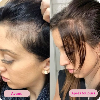 VitalHair Pro |  Massage Cuir Chevelu