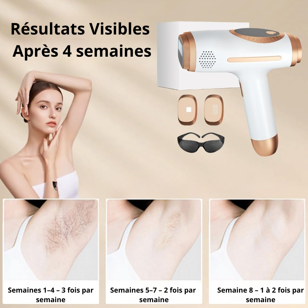 InfiniteSilk™ – Le laser d’épilation intelligent à domicile