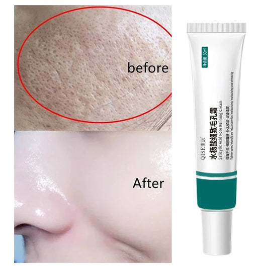 Sérum à l'Acide Salicylique