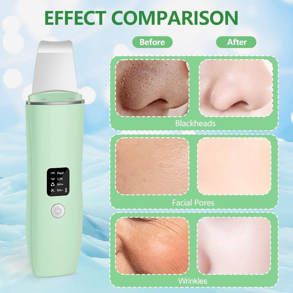 Purificateur Ultrasonique Visage