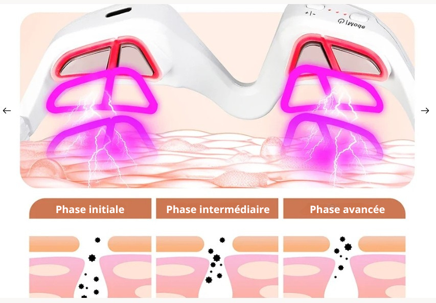 OcuLift Pro – Thérapie pour Contour des Yeux